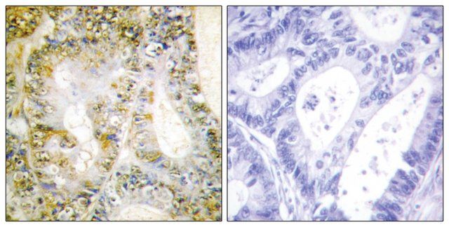 Anti-Catenin-1 antibody produced in rabbit