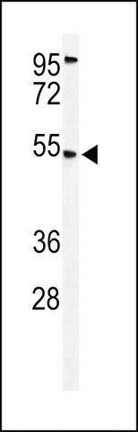 ANTI-CBAA1 (N-TERM) antibody produced in rabbit