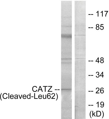 Anti-CATZ (Cleaved-Leu<sup>62</sup>) antibody produced in rabbit