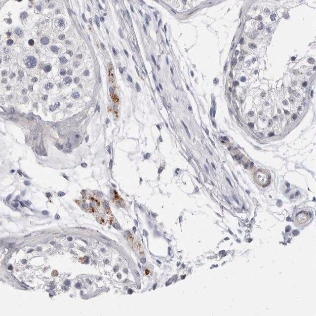 Anti-CATSPERD antibody produced in rabbit