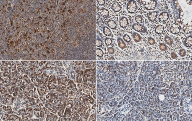 Anti-Cathepsin S