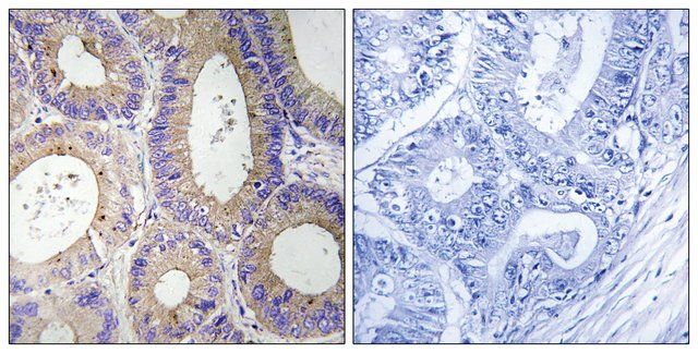 Anti-CBR3 antibody produced in rabbit