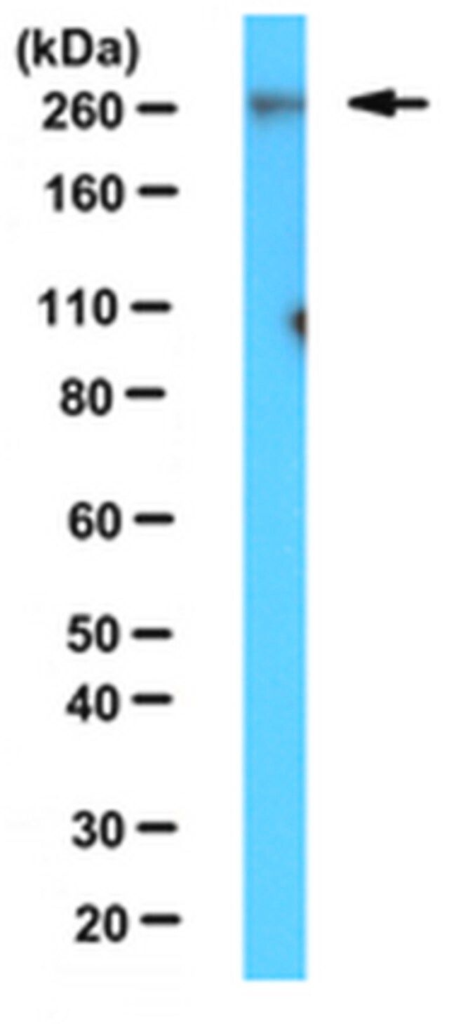 Anti-Cav3.2 Calcium Channel Subunit Antibody, clone N55/10