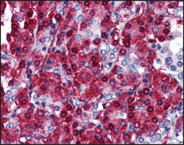 Anti-CBLC antibody produced in rabbit