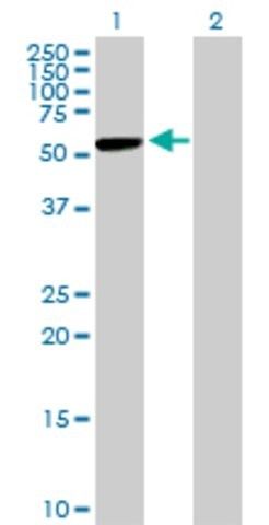 Anti-CBS antibody produced in mouse