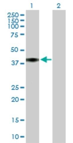 Anti-C4BPB antibody produced in mouse