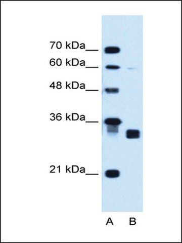 Anti-CBR1 antibody produced in rabbit