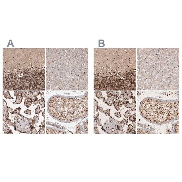 Anti-CBLL1 antibody produced in rabbit