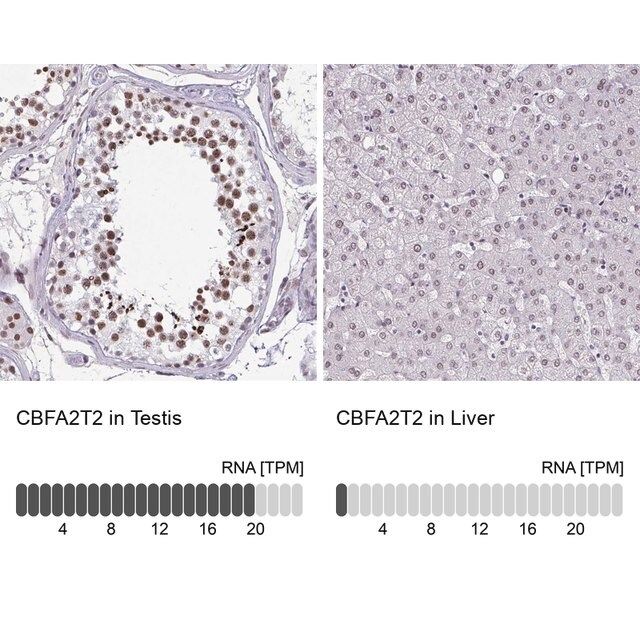 Anti-CBFA2T2 antibody produced in rabbit