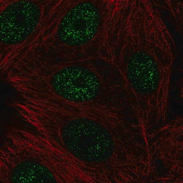 Anti-CBFA2T3 antibody produced in rabbit