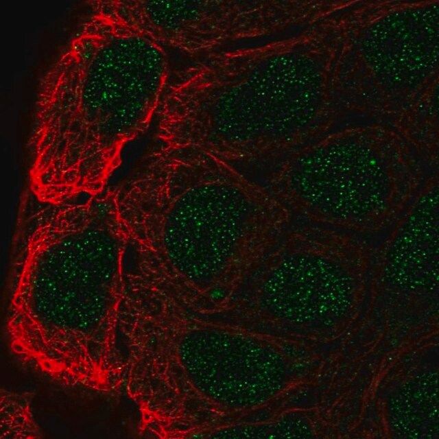 Anti-CBLC antibody produced in rabbit