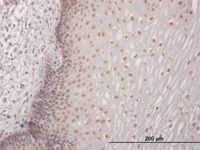 Anti-CBFA2T3 antibody produced in mouse