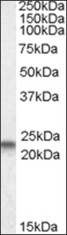 Anti-CAV3 (N-terminal) antibody produced in goat