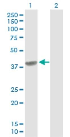 Anti-C4BPB antibody produced in rabbit