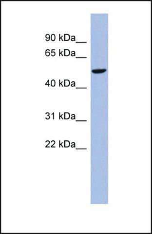 Anti-CBLL1, (N-terminal) antibody produced in rabbit