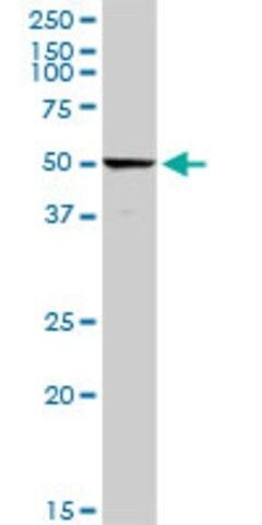 Anti-C4BPA antibody produced in rabbit