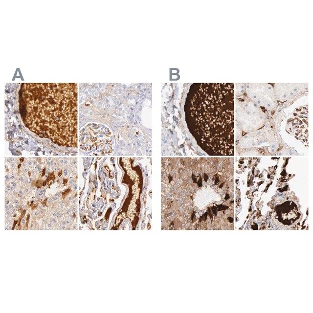 Anti-C4BPA antibody produced in rabbit