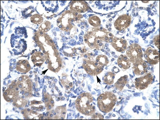 Anti-CBX4 antibody produced in rabbit