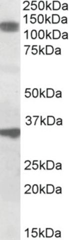 Anti-CCAR1 antibody produced in goat