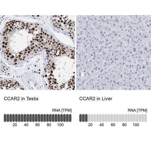 Anti-CCAR2 antibody produced in rabbit