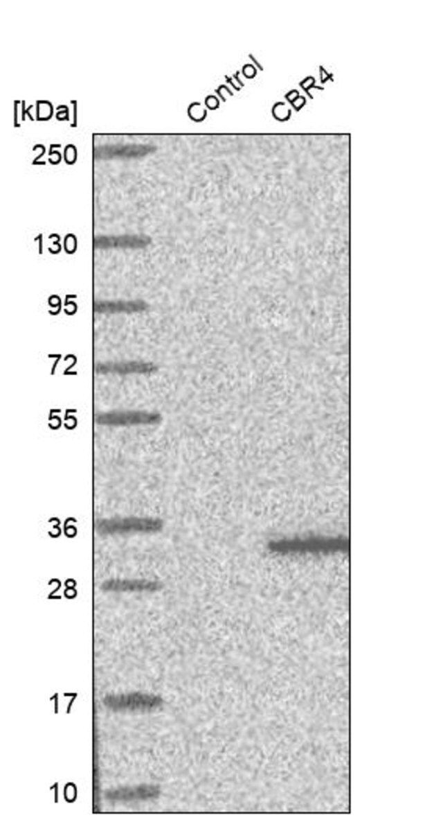 Anti-CBR4 antibody produced in rabbit