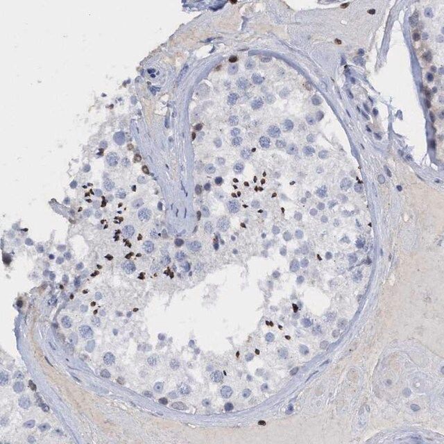 Anti-CBX2 antibody produced in rabbit