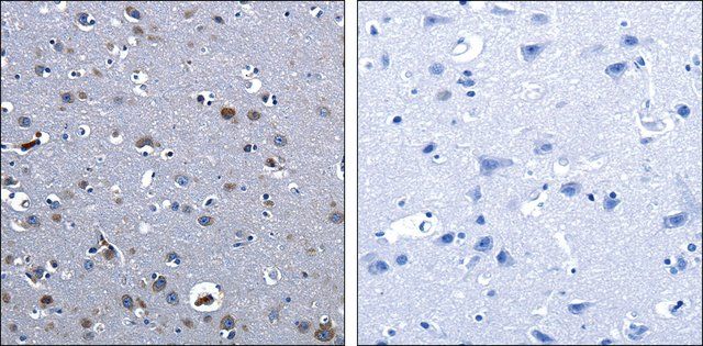 Anti-CBFA1 antibody produced in rabbit