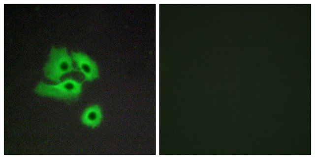 Anti-CCBP2 antibody produced in rabbit