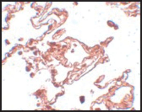 Anti-CCDC69 antibody produced in chicken