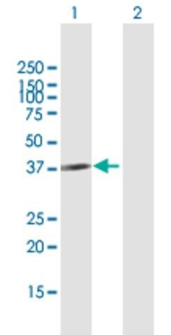 Anti-CBX4 antibody produced in mouse