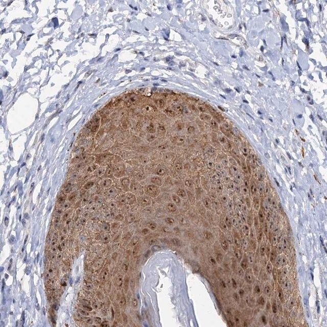 Anti-C2CD3 antibody produced in rabbit