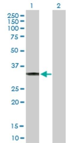 Anti-CBR3 antibody produced in rabbit