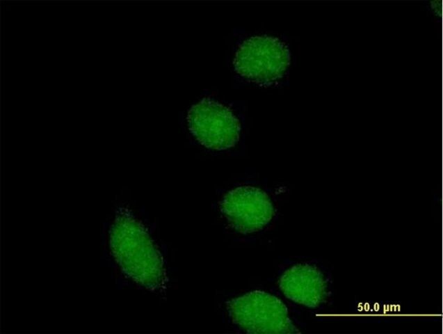 Anti-CBFA2T2 antibody produced in mouse