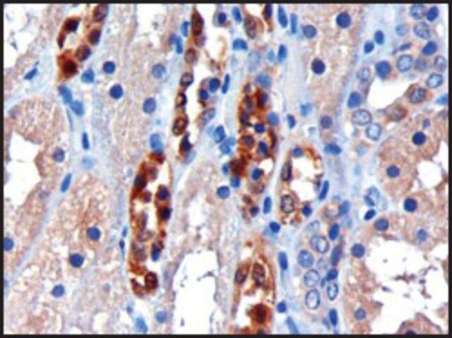 Anti-CBR1 antibody produced in goat