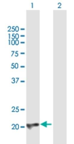 Anti-CBFB antibody produced in mouse