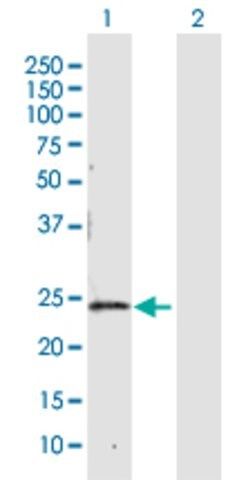 Anti-CBR4 antibody produced in rabbit