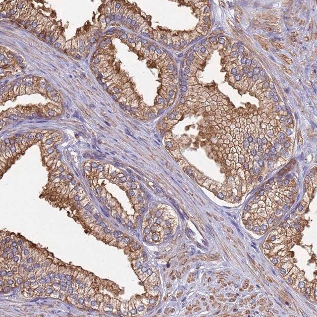 Anti-CBWD1 antibody produced in rabbit