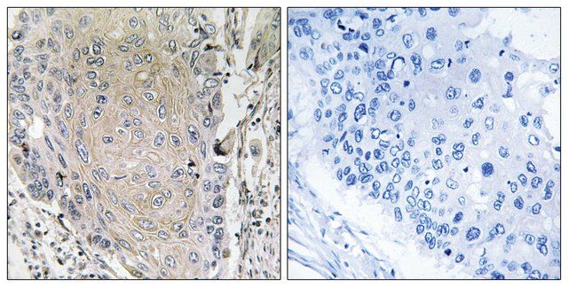 Anti-CBLN3, antibody produced in rabbit