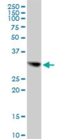 Anti-CBR1 antibody produced in mouse