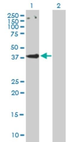 Anti-CCBP2 antibody produced in mouse