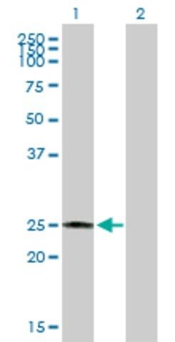 Anti-CBR4 antibody produced in mouse