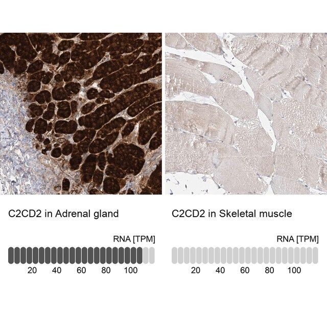 Anti-C2CD2 antibody produced in rabbit