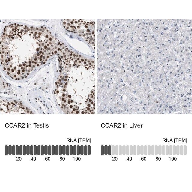 Anti-CCAR2 antibody produced in rabbit