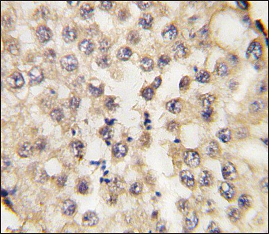 Anti-CCDC5 (N-term) antibody produced in rabbit