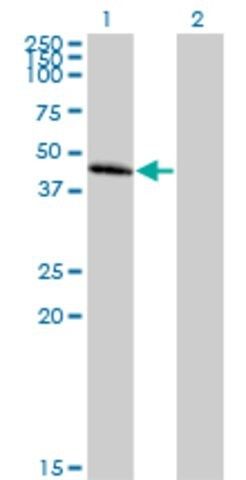 Anti-CCBP2 antibody produced in mouse