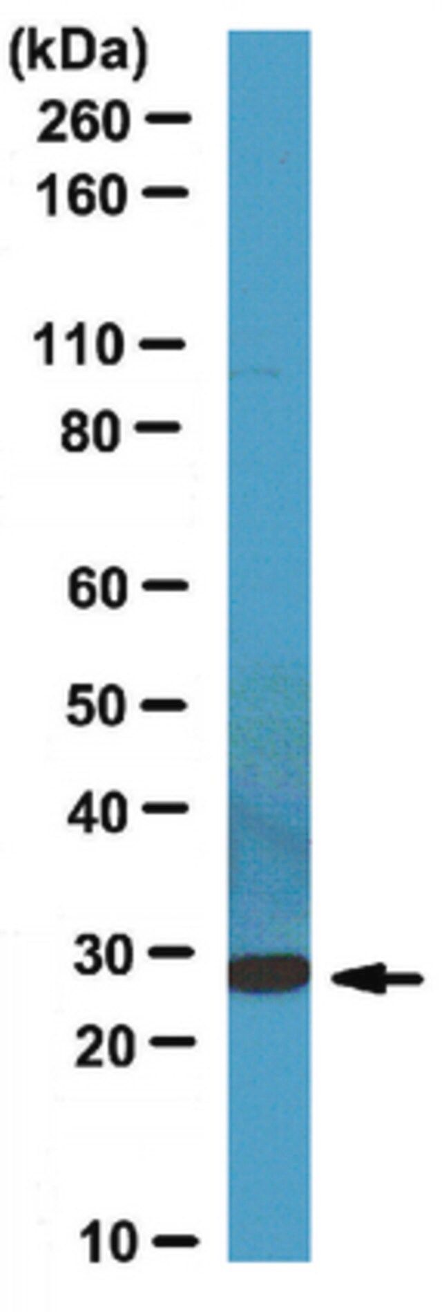 Anti-CCDC53 Antibody