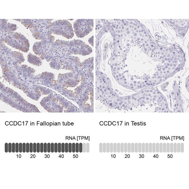 Anti-CCDC17 antibody produced in rabbit