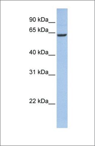 Anti-CCDC67 antibody produced in rabbit