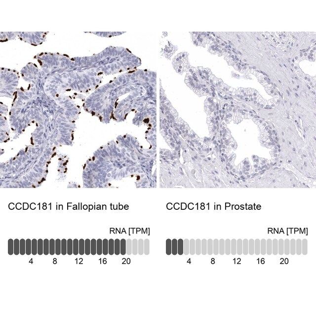 Anti-CCDC181 antibody produced in rabbit