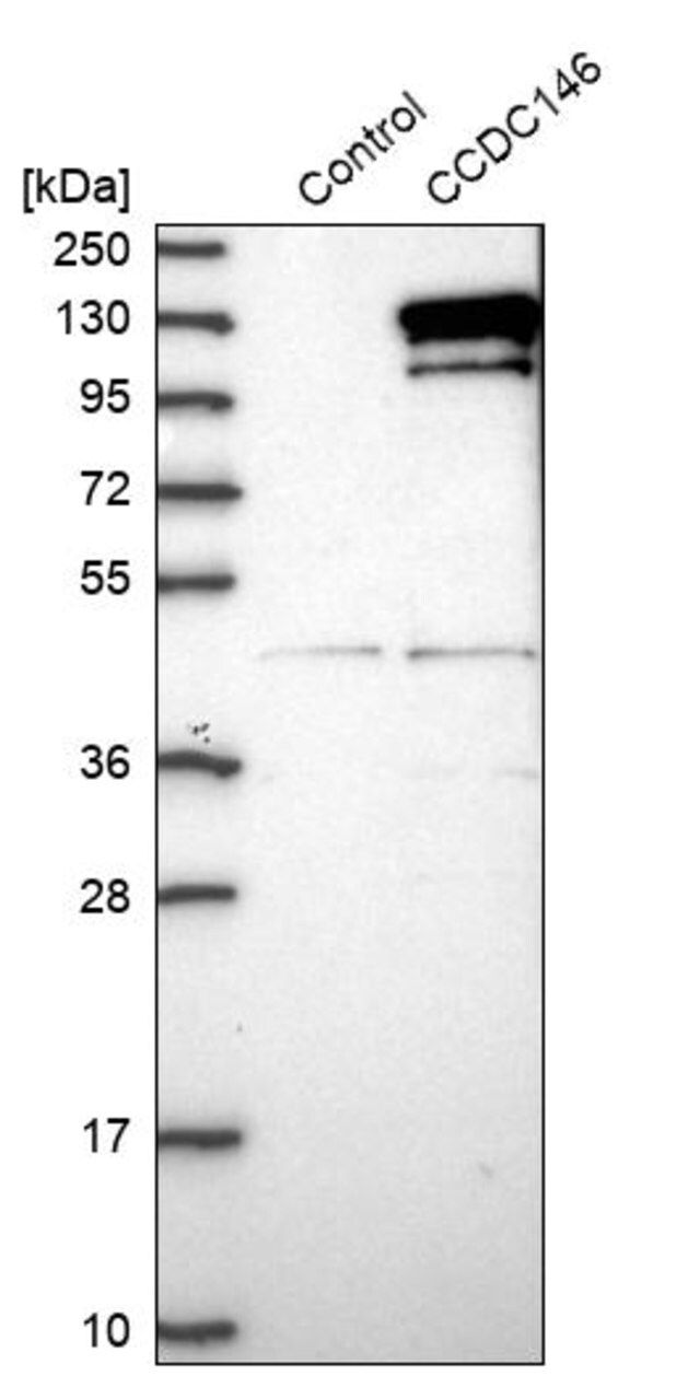 Anti-CCDC146 antibody produced in rabbit